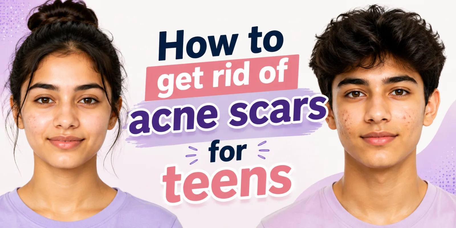 Cover photo illustrating the skincare guide: How to Get Rid of Acne Scars for Teens: A Dermatologist's Guide